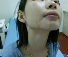 青少年白癜风患者要怎么摆正心态?(图1) 青少年白癜风患者要怎么摆正心态?(图1)