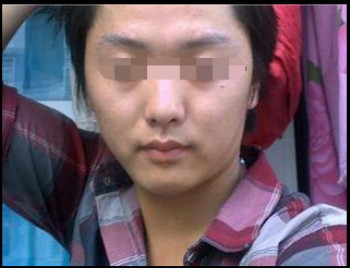 白癜风是怎样引起的?(图1) 白癜风是怎样引起的?(图1)